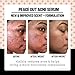 PEACE OUT Skincare Acne Serum. Daily Multi-Benefit Face Serum with 2% Salicylic Acid to Target Pimples, Zits, Blemishes and Breakouts, For Clearer-Looking Skin 1 fl oz