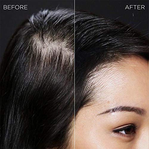 IMMETEE Keratin Hair Building Fibers Powder Conceal Instantly for Thinning Hair,Cover Up Hair Loss Natural Thickens for Men and Women-25g/0.88oz (MEDIUM BLONDE) - Thumbnail 3
