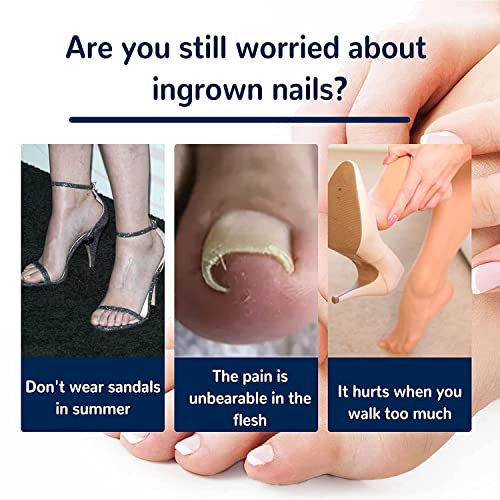 Treatment Ingrown Toenail Corrector Strips,Fitmedify Nail Patches with Nail Correction Tool Kit,Toenail Correction Patch,Ingrown Toenail Removal Kit - Image 3