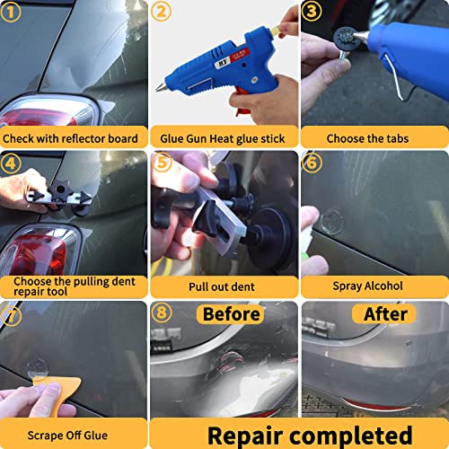 Teen Dream 97Pcs Paintless Auto Body Dent Puller Kit, Car Dent Removal Kit With Golden Lifter Bridge Puller Slide Hammer T-Bar Dent Puller Suction Cup And Glue Gun For Car Dent Repair (97Pcs) #TOP7