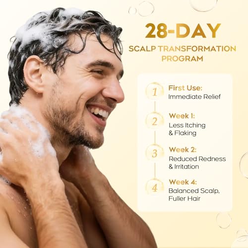 Image of Enhanced Antifungal Shampoo for Seborrheic Dermatitis & Folliculitis-Fresh