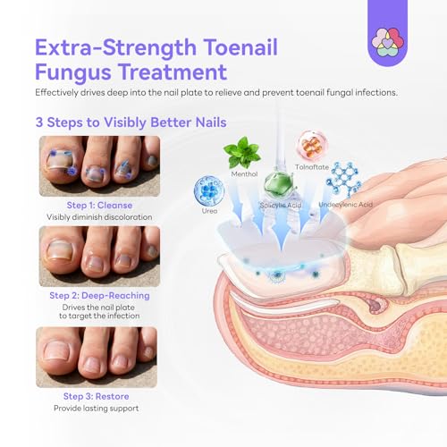 Image of SAVILAND Toenail Fungus Treatment Extra Strength FSA-HSA: 2X Extreme Nail Repair for Discolored and Damaged Nails Toenail Softener Yellow Toenail Foot Toe Thick Nail Fungus Treatments Solution 1 fl oz