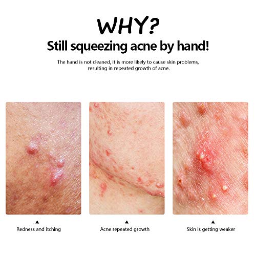 Mee-eter Verwijderaar Set - 8 Stuks, Professionele Roestvrijstalen Risicovrije Mee-eter Extractor-gereedschapsset… - Afbeelding 8