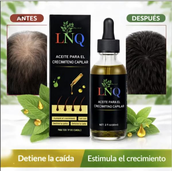 Aceite Capilar Herbal LNQ – Fórmula Natural para Crecer, Fortalecer y Engrosar el Cabello