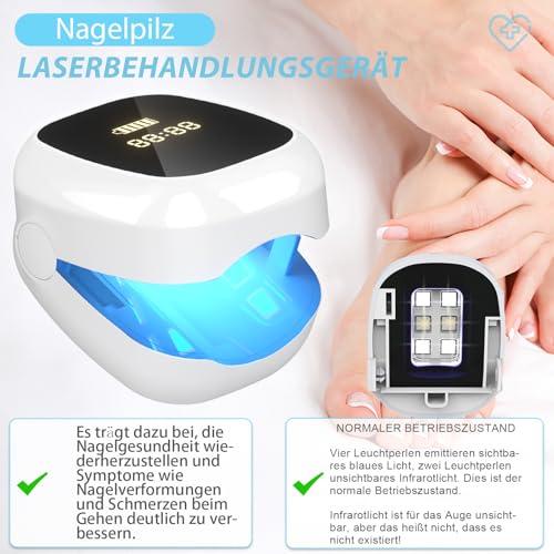 Nagelpilz Lasergerät für Enzelne Nägel – 500nm Blaulicht & 940nm Infrarot,Nagelpflege für Verfärbte und Verdickte Finger- und Zehennägel,Tragbar,mit Timerfunktion,Wiederaufladbar für Zuhause(Weiß)