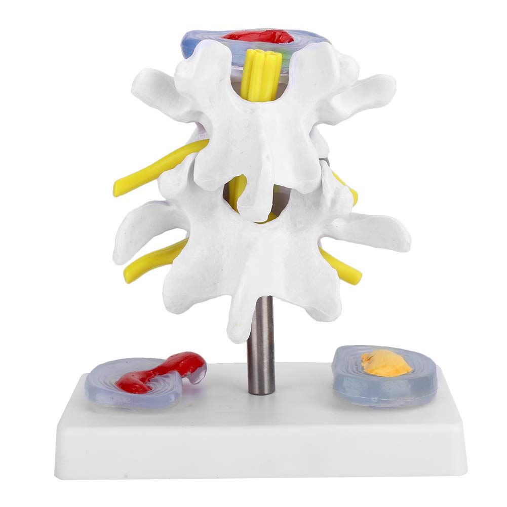 Menschliches Lendenwirbelmodell, menschliches anatomisches Skelettmodell Lendenwirbelmodell mit abnehmbarer Basis Einfach zu installieren Helfen Sie Menschen, den Zustand der Wirbelsäule zu überwachen