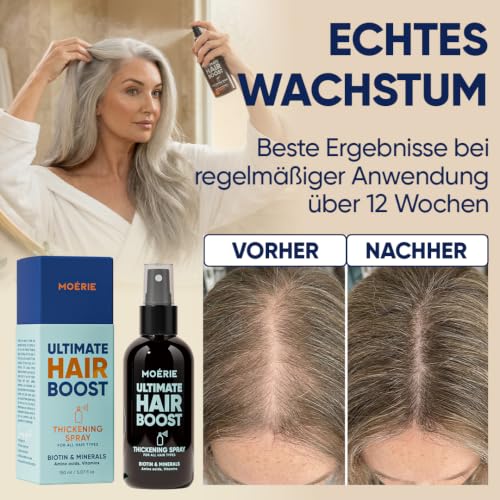 MOERIE Haarwachstum Serum Spray 150ml - natürlich Haarwachstum beschleunigen - Haarwuchsmittel Frauen & Männer - mit Mineralien, Caffein & Biotin Haare stärken - Haarvitamine gegen Haarausfall Frau
