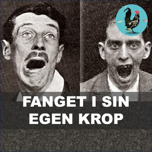 #261: Den ukendte sygdom der gjorde folk til levende statuer