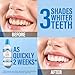GuruNanda Oxyburst Teeth Whitening Mouthwash – Alcohol & Fluoride Free, with Hydrogen Peroxide & 7 Essential Oils, Value Size for Regular Use, Wild Mint, 1 Liter/33.8 fl oz