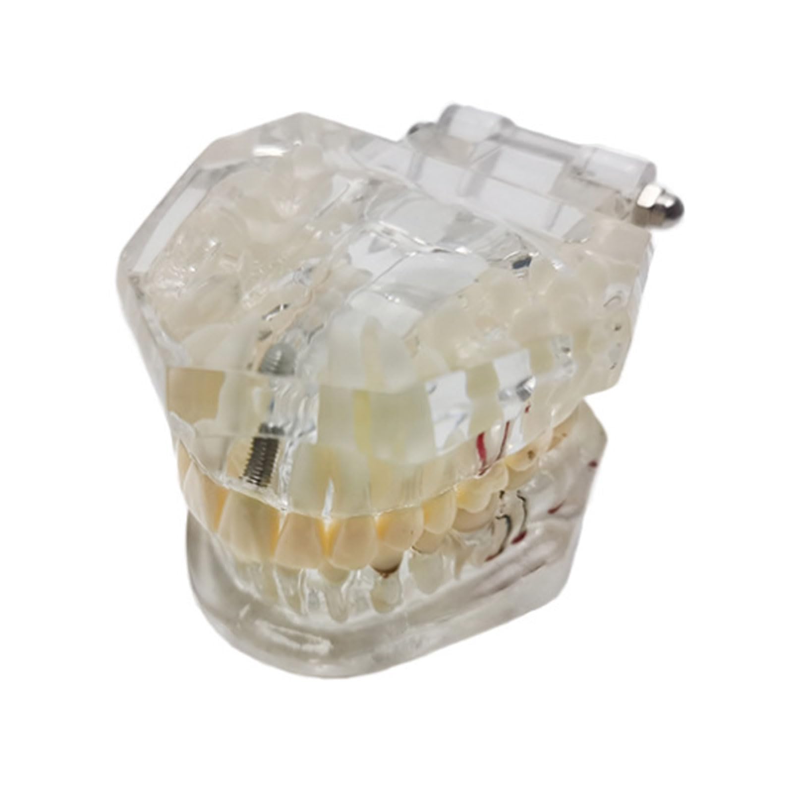 Modello Dentale Denti Impianto Restauro Ponte Insegnamento Studio Scienza Medica Malattia Dentista Odontoiatria Prodotti Regalo Dentale