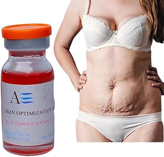 Cream For Stretch Marks for Women | Fades Stretch Marks | (35ml)| 90 Days Permanent Treatment |