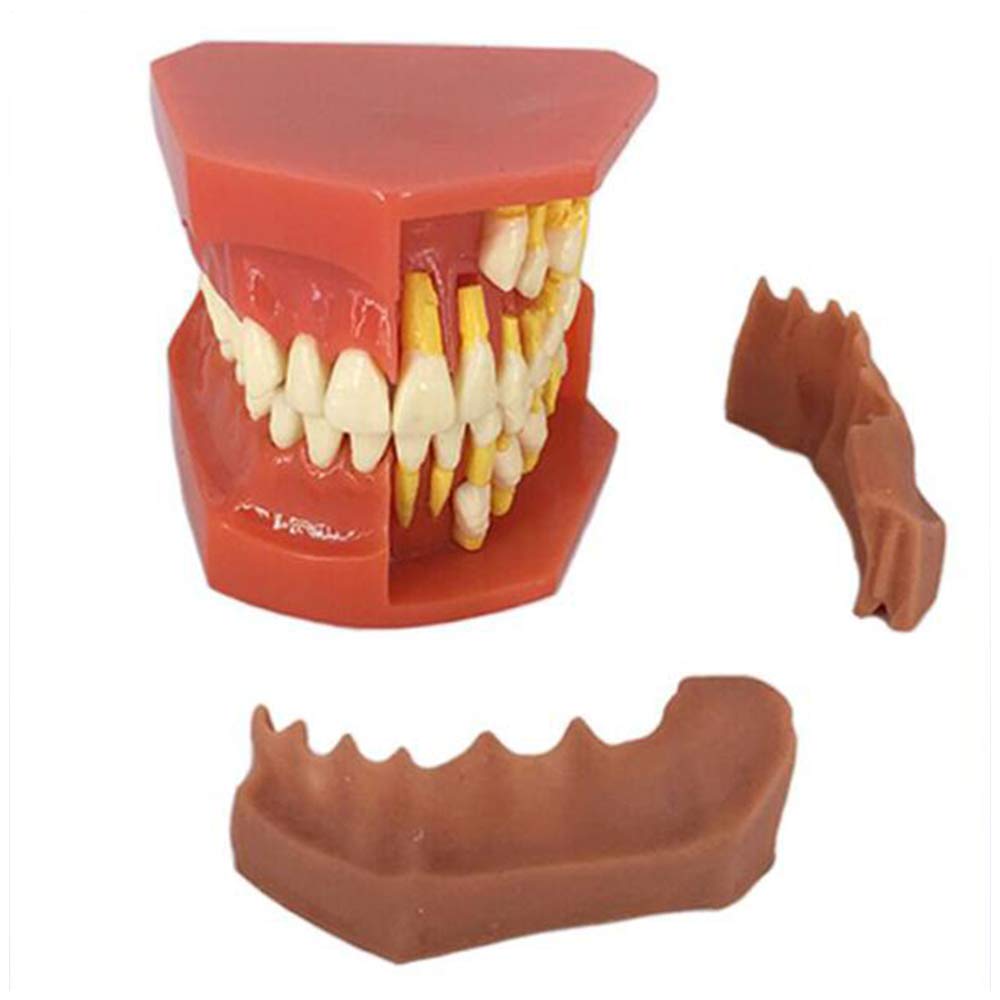 Sjdopulse Light Dental Teeth Model Deciduous Teeth Model - Teeth Teaching Model - Teeth Gums Standard Demonstration Model - For Doctor-Patient Communication Model