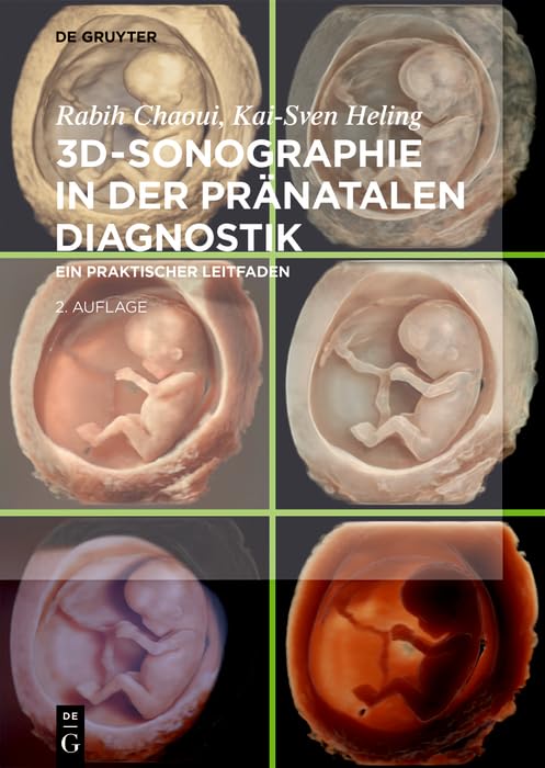 3D-Sonographie in der pränatalen Diagnostik: Ein praktischer Leitfaden