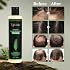 Tgideas Organic Rosemary Shampoo and Biotin Shampoo & Conditioner Set Bundle