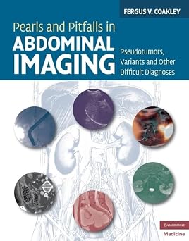 Pearls and Pitfalls in Abdominal Imaging Pseudotumors, Variants and Other Difficult Diagnoses Cambridge Medicine Hardcover