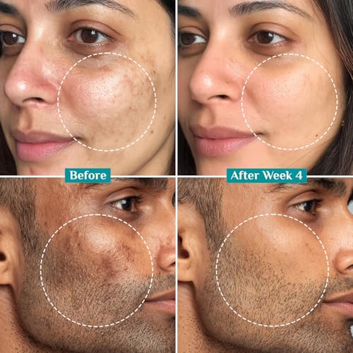 Pilgrim 15% Vitamin C Serum 10ml For Glowing Skin | Advanced Formulation With Ferulic Acid & Vitamin E |Reduces Dark Spots, Pigmentation |For All, Oily, Combination, Normal Skin |Men, Women - Image 6