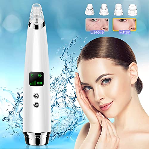 Handsomeface Blackhead Remover Pore Cleaner Electric Blackhead Suction, Facial Pore Cleaner Device Acne Comedone Extractor Tool USB with Hot Compress 4 Probes for Nose Face, White