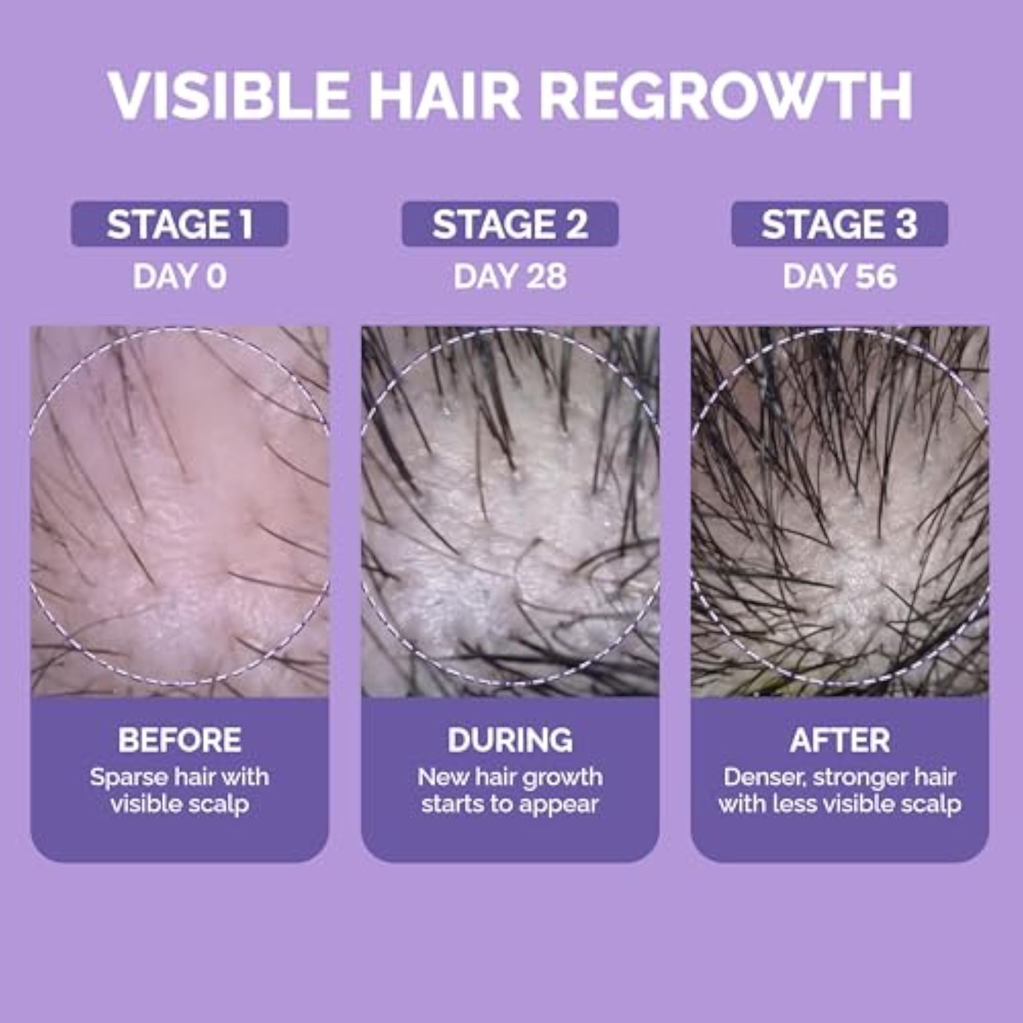 Hair Growth Spray, 100ml