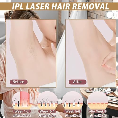 Laser Hair Removal for Women Permanent,Hair Removal Device,Painless At-Home IPL laser Hair Removal,999900 Flashes,Whole Bodey Use