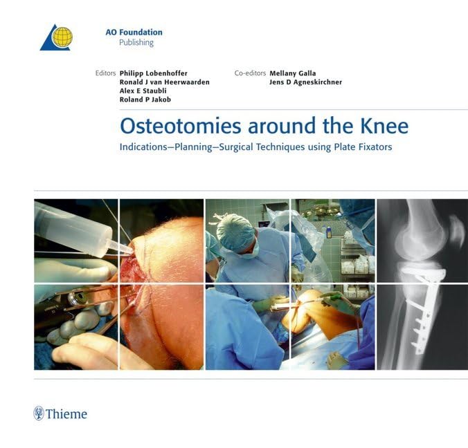 Buy Osteotomies Around the Knee: Indications-Planning-Surgical