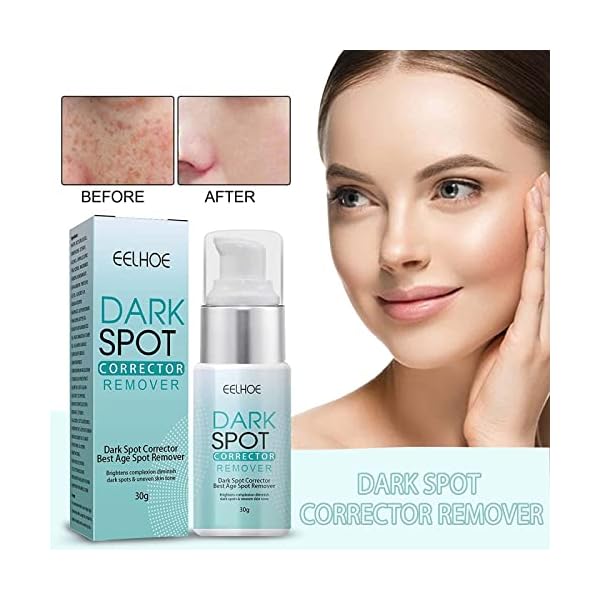 3Pack Musely Dark Spot Cream,The Spot Cream for Face,Dark Spot Correct