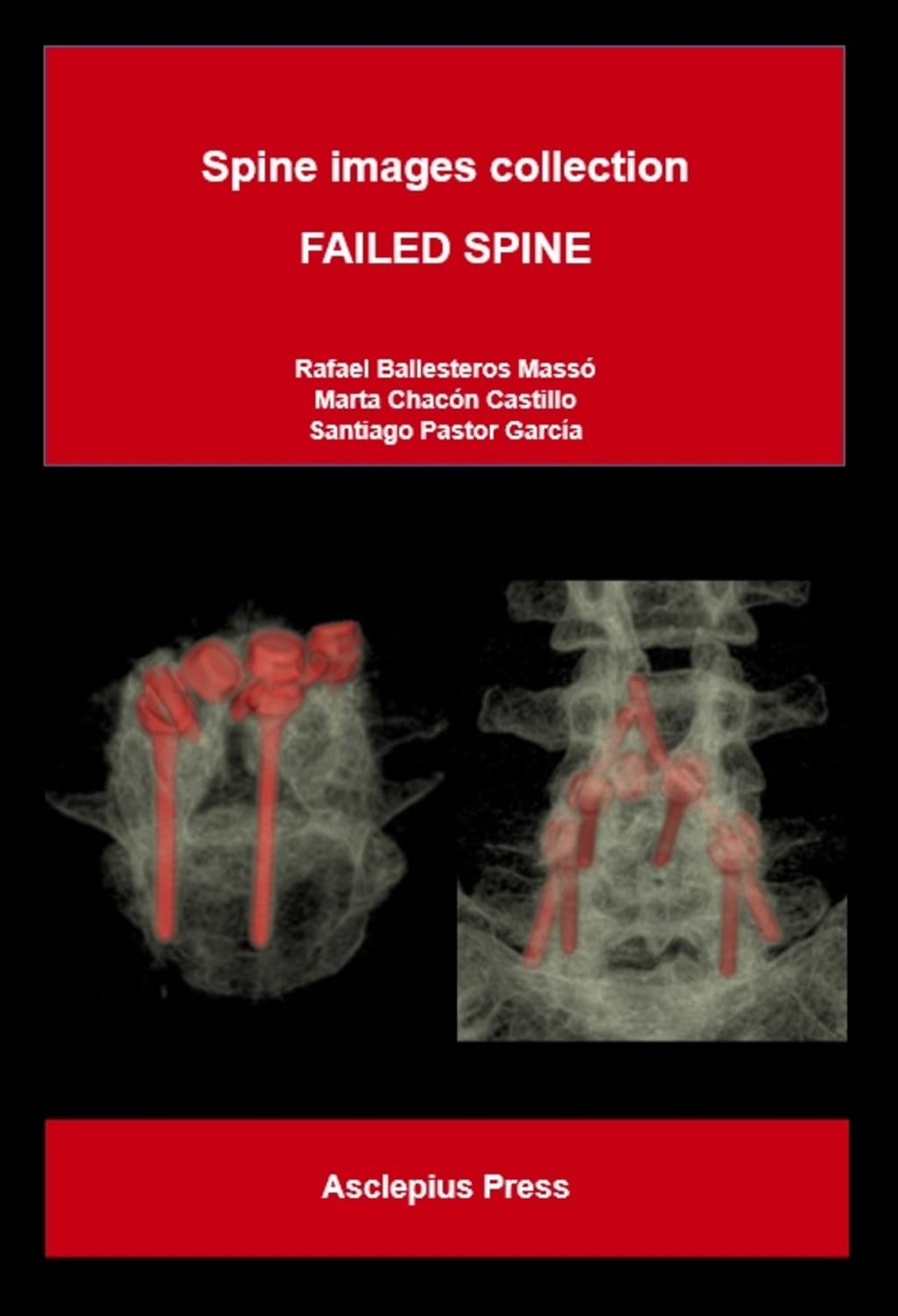 FAILED SPINE: Spine images collection