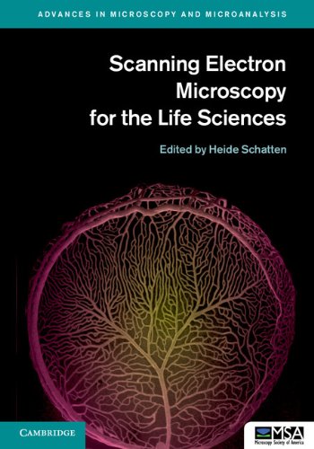 Amazon | Scanning Electron Microscopy for the Life Sciences (Advances ...