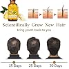 5-Pack-Hair-Growth-SerumGinger-Biotin-Hair-Regrowth-Oil-Prevent-Hair-Loss-and-Natural-Serum-for-Thicker-Stronger-Longer-Hair-Men-and-Women 5 Pack Hair Growth Serum,Ginger Biotin Hair Regrowth Serum Prevent Hair Loss and Natural Serum for Thicker, Stronger, Longer Hair Men and Women