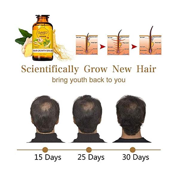 5-Pack-Hair-Growth-SerumGinger-Biotin-Hair-Regrowth-Oil-Prevent-Hair-Loss-and-Natural-Serum-for-Thicker-Stronger-Longer-Hair-Men-and-Women 5 Pack Hair Growth Serum,Ginger Biotin Hair Regrowth Serum Prevent Hair Loss and Natural Serum for Thicker, Stronger, Longer Hair Men and Women