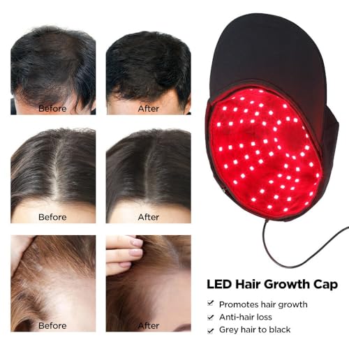 Image of Bequest Laser Cap with 96 US FDA Approved & Clinically Proven Hair Loss Treatment at Home | Low Level Laser Therapy For Hair Regrowth In Men & Women