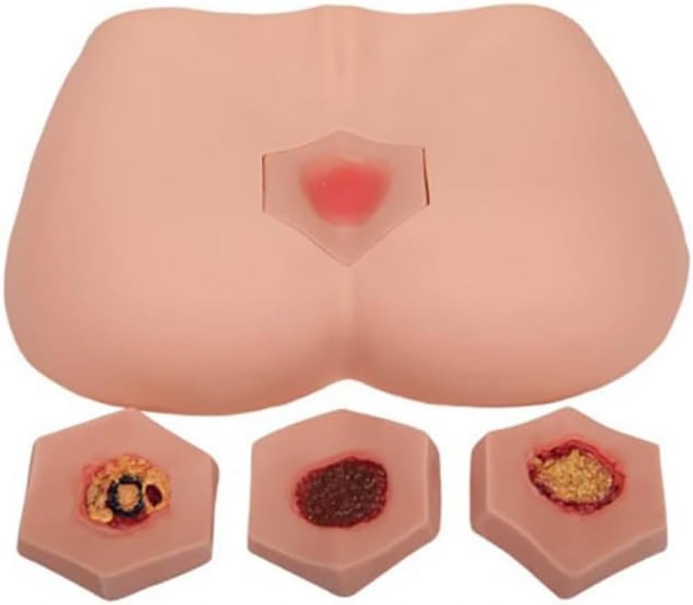 4-Stage Decubitus Ulcer Care Model for Nursing Training