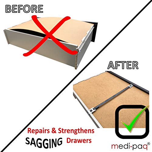 Strongest Band on Market! - Drawer Doctor Repair A Drawer x 3 - Mend Broken Buckled Drawers - Fix in Minutes