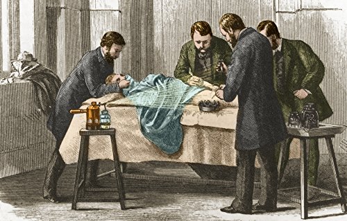 Listers Antiseptic Spray Surgery 19th Century Poster Print by Science Source (36 x 24)