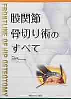 股関節骨切り術のすべて | 糸満 盛憲 |本 | 通販 | Amazon