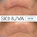 Skinuva® Next Generation Scar Cream - Advanced Scar Cream Formulated with Growth Factors (1 oz)