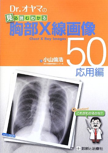 スマホ 無料電子書籍 Dr.オヤマの見る読むわかる胸部X線画像50 応用編 バイ