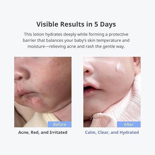 Miniatura 2 de CHA&MOM Korean Baby Skincare - Loción hidratante Phyto Seline hipoalergénica, a base de plantas y natural, 8.46 onzas