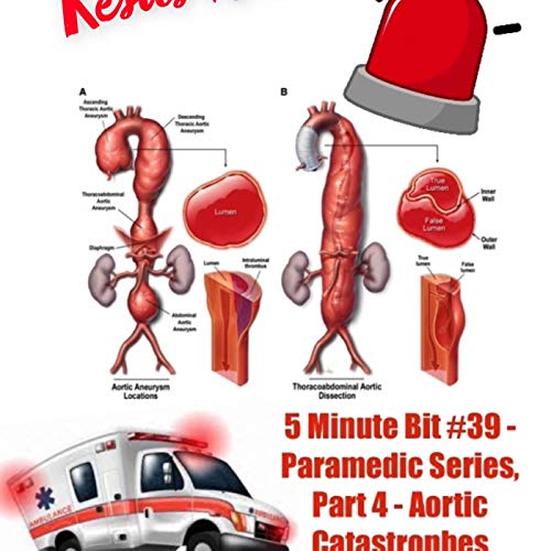 5 Minute Bit #39 - Paramedic Series, Part 4 - Aortic Catastrophe