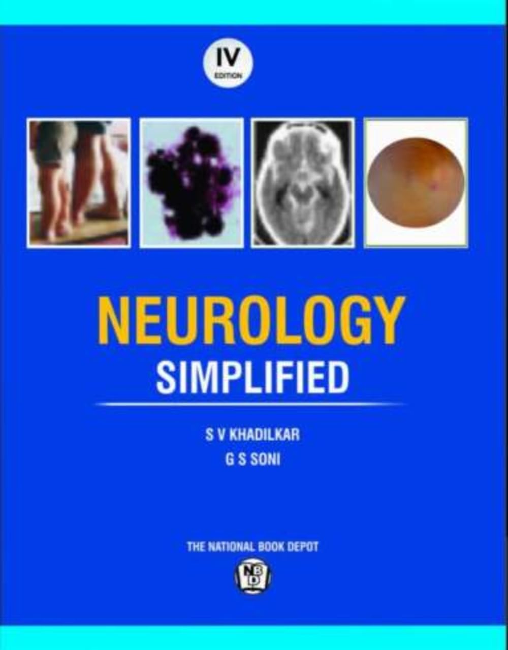 健康・医学 Advances in Neurology Volume 56 Buy NEUROLOGY SIMPLIFIED 4ED (PB 2026) Book Online at Low Prices