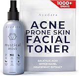 Ayadara Acne Prone Skin Facial Toner | 2% Salicylic Acid Spray for Cystic & Hormonal Acne | Witch Hazel Face Toning Treatment for Women & Men | Acne Eliminating Mist | 1000+ Sprays