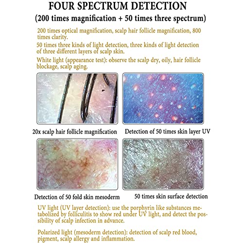 Testador de cabelo Analisador de folículo capilar Diagnóstico de pele Analisador de cabelo 50X/200X