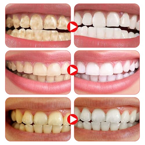 Sp-6 Zahnpasta,Sp6 Zahnpasta,120g Probiotische Zahnpasta,Sp-6 Probiotic Zahnpasta,Sp 6 Probiotische Zahnpasta Zur FleckenentfernungZur Entfernung Von Zahnaufhe – Bild 3