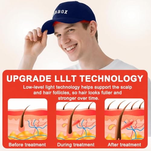 Image of Red Light Therapy for Hair Growth for Men & Women,Red Light Hair Growth Cap,Full-Scalp Coverage,At-Home Scalp Care, Father's Day Gift Idea,Blue Cap