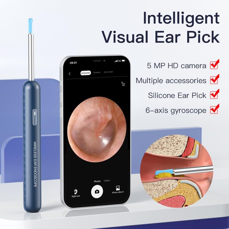 V88R®Ear Wax Removal CleanerTool,Wireless Otoscope,Ear Cleaner with Camera,1080P FHD Video Otoscope Compatible with iPhone & Android, Video Suitable for Kids, Adults & Pets