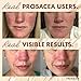 Prosacea - Medicated Rosacea Treatment for Face - Heals Rosacea Symptoms of Redness, Pimples and Irritation - Fragrance Free - Twin Pack - Two 0.75oz Tubes (1.5oz Total)