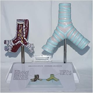Trachea Model - Human Organ Anatomical Model Visceral Trachea Model Comparative Smoking Trachea and Normal Tracheai Anatomy Medical Study Model
