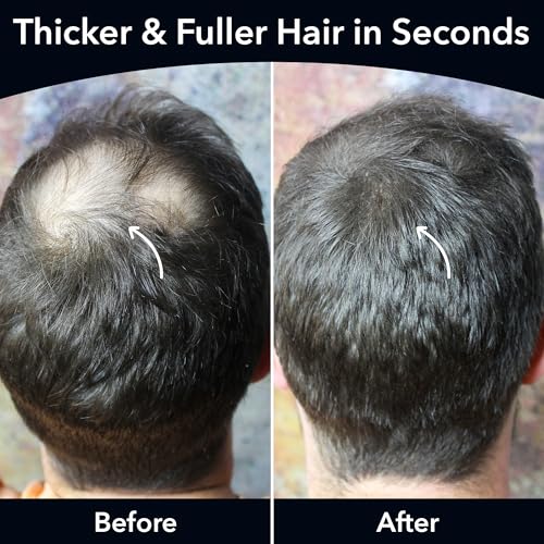 HAIR GURU LONDON Thickening Fibres 28g | 15 Colours | Instantly Conceals Hair Loss or Thinning Patches | Full & Thick Hair In Seconds | Hair Powder for Women & Men (Black) - Image 6