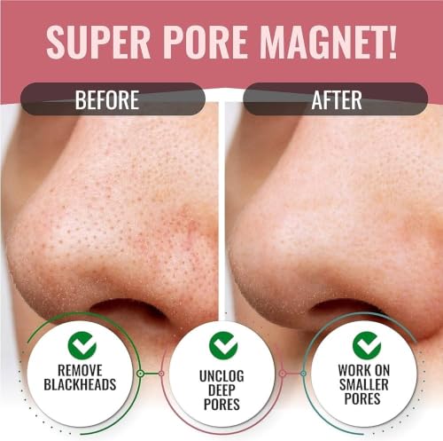 Image of Charcoal Nose Strips for Blackheads & Whiteheads | Deep Cleansing Pore Strips for Smoother Looking Skin | Unisex Skin Care (10x Butterfly Coffee Nose Strips)
