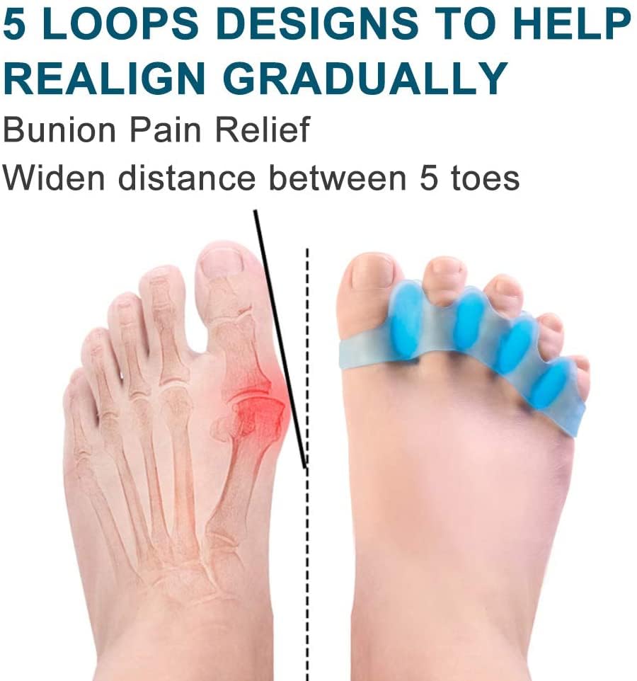 Miniatura 2 de 6 piezas  Separadores de dedos graduados para corregir juanetes, corrector de juanetes para mujeres y hombres, alisador de dedos en martillo para