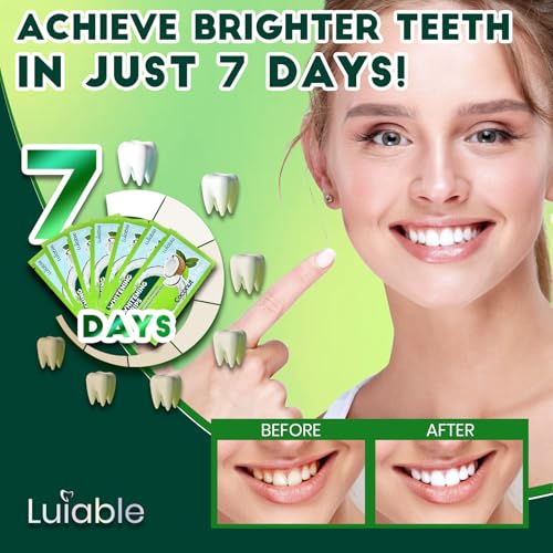 Image of Teeth Whitening Strips for Tooth White: Professional Dentist Formulated Teeth Whitener Enamel-Safe Non-Slip 14 Strips 7 Treatments (14 Count (Pack of 1), Coconut Mint)